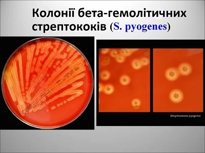 Діагностика
