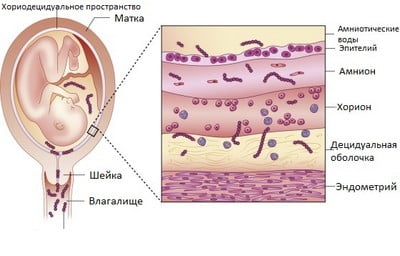 Патогенез и факторы риска